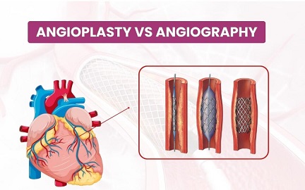 Difference Between Angiography